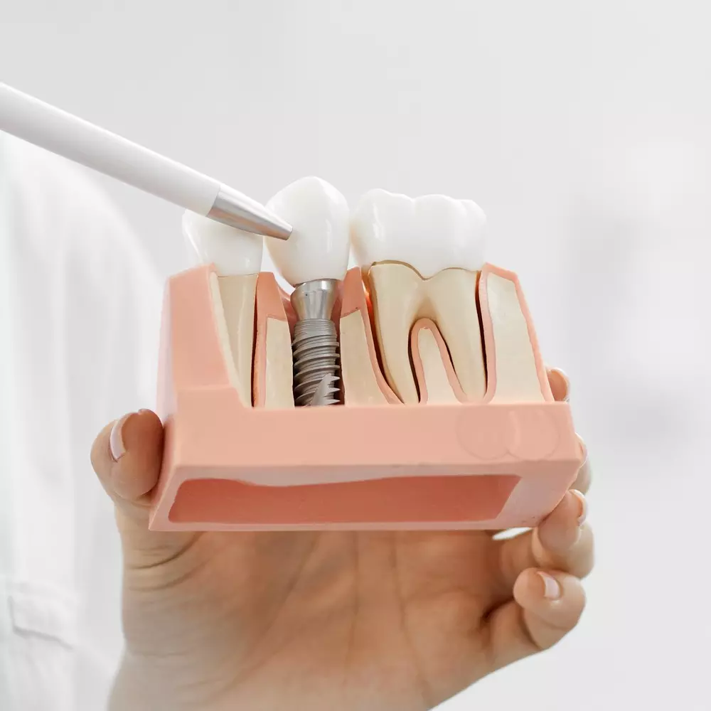 Oralchirurgie Kortumhaus